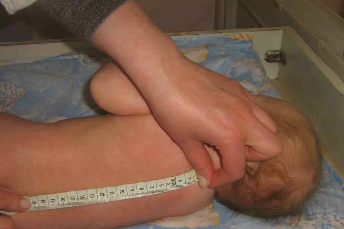 Измерение роста грудного ребенка. Гипертермия у новорожденных. Термометрия новорожденных. Измерение длины тела (у детей до 1-го года). Термометр для тела новорожденного.