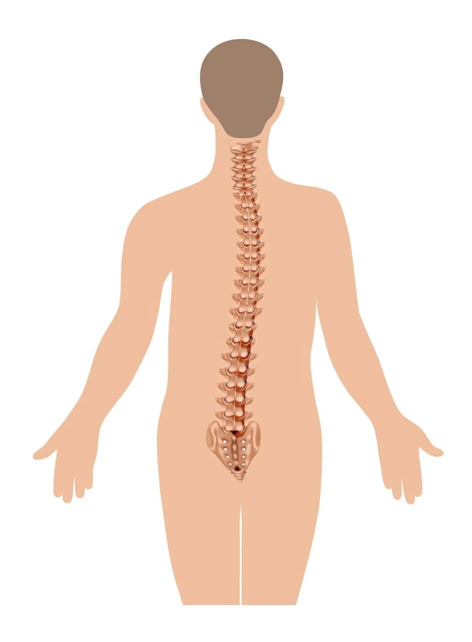 Сколиоз позвоночника s образный. S образный сколиоз 2 степени. S образный сколиоз 1 степени. Сколиоз s1.