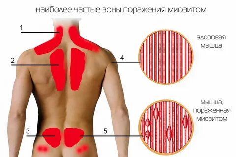 Почему болит поясница. Лечение боли в поясничном отделе