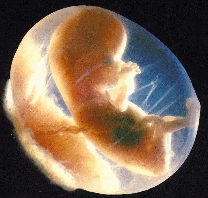 Конец первого триместра. Беременность 1 триместр эмбрион. Эмбрион 1 месяц беременности. Второй триместр зародыш.