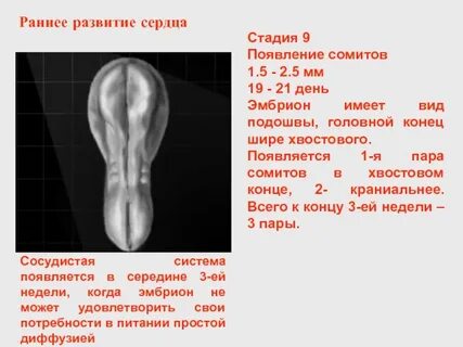 Головной конец