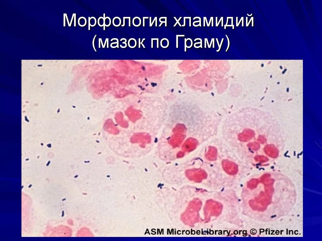 Chlamydia trachomatis. Chlamydia trachomatis окраска по Граму. Хламидии морфология микробиология. Хламидии мазок микробиология. Chlamydia trachomatis микроскопия.