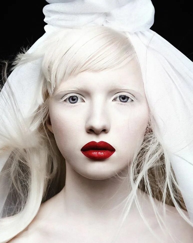 Ola rudnicka альбинос. Самый белый человек. Катерина тимошенко альбинос. Европеоидная раса альбиносы. Магнолия цветок жук.