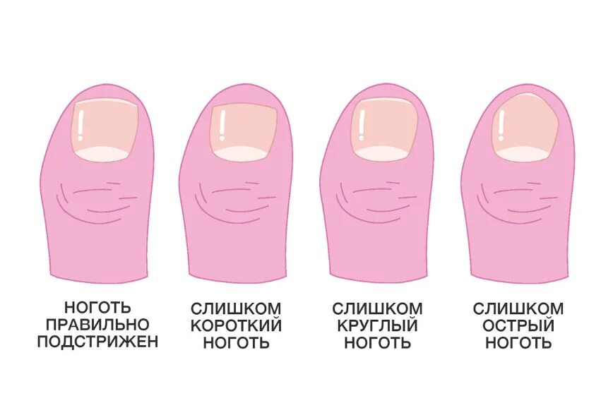Как правильно подстригать ногти. Правильно стричь ногти. как правильно стричь ногти. правильно стричь ногти на ногах. как правильно подстригать ногти на ногах.