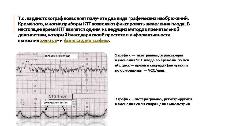 Что значит тонус матки при беременности. Показатели маточных сокращений на ктг. сокращение матки на ктг норма. тонус матки на ктг расшифровка. показатель схватки на ктг при беременности.