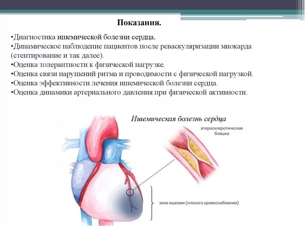 Ишемия смерть. Выявление ишемической болезни сердца. Принципы диагностики ишемической болезни сердца. Основной метод диагностики ишемической болезни сердца. Методы исследования при ишемической болезни сердца.