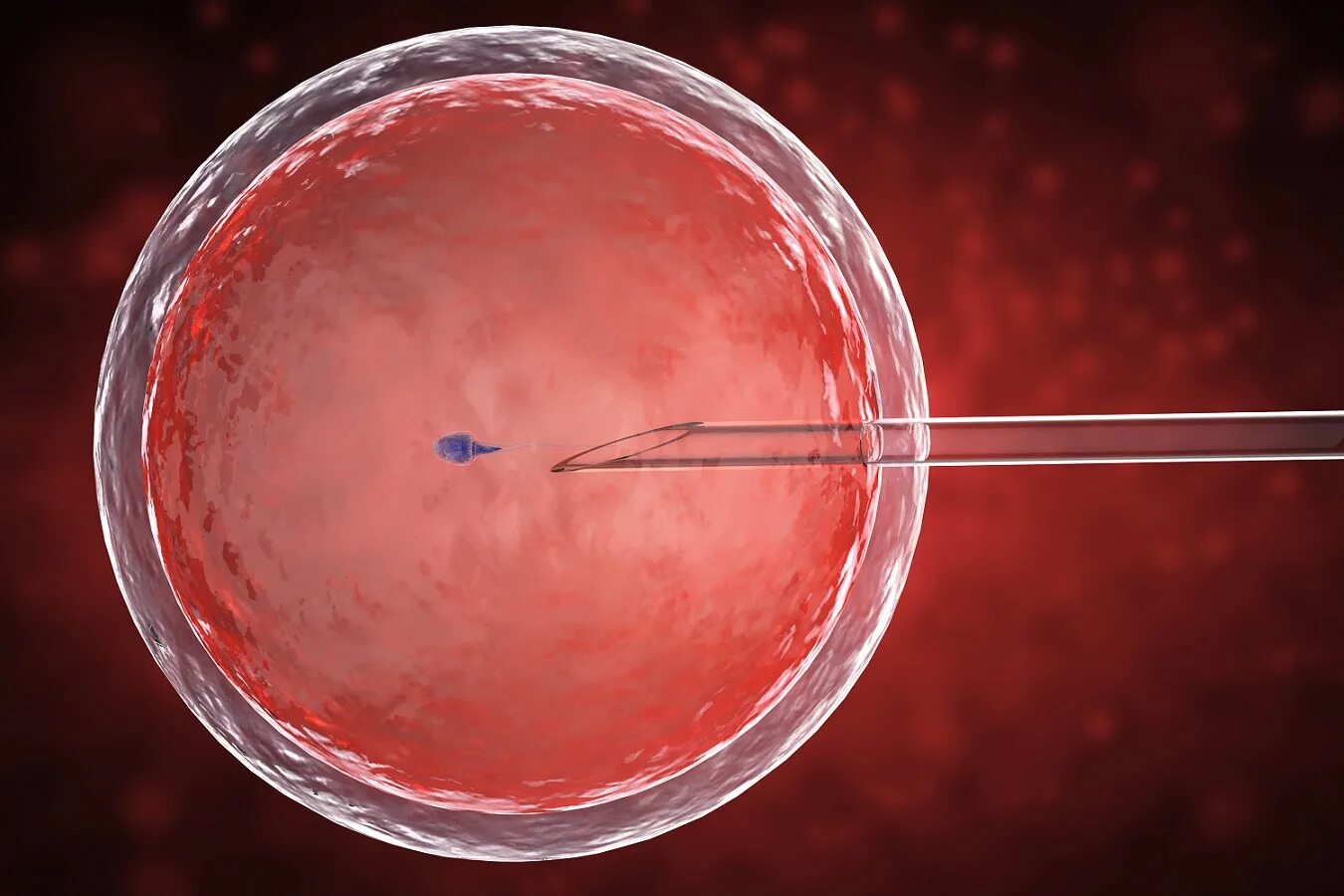 Оплодотворение яйцеклетки in vitro. Оплодотворение яйцеклетки ИКСИ. Искусственное оплодотворение ИКСИ. Эко ИКСИ оплодотворение in vitro. Искусственное бесплодие