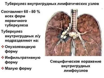 Первичный туберкулез тест