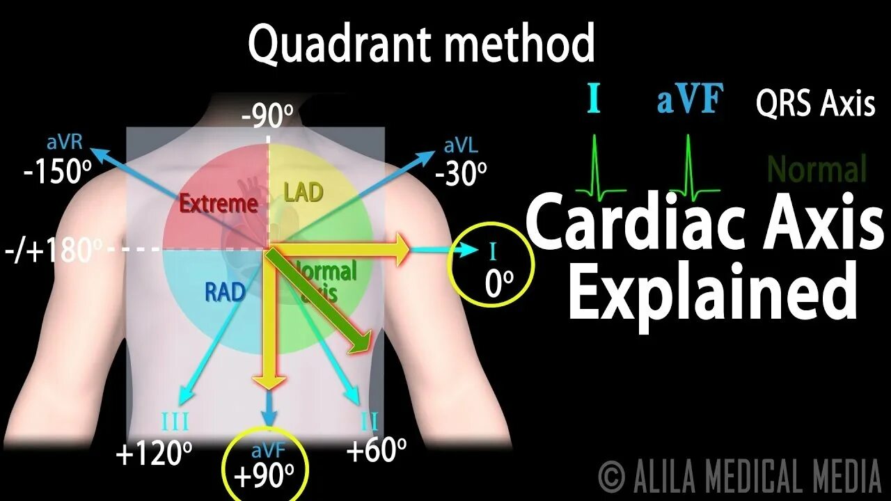 Axis значение. Cardiac axis. qrs axis. axis deviation. entero-cardiac axis.