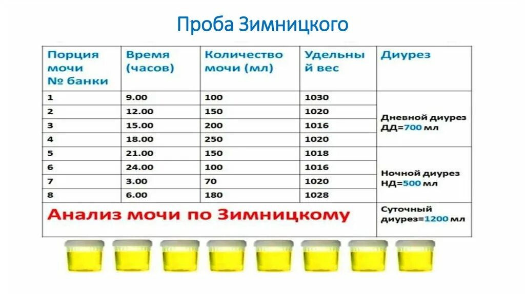 170 0 8. Анализ мочи проба по Зимницкому норма. Исследование мочи по Зимницкому норма. - Анализ мочи по Нечипоренко; - анализ мочи по Зимницкому. Анализ мочи по Зимницкому норма.