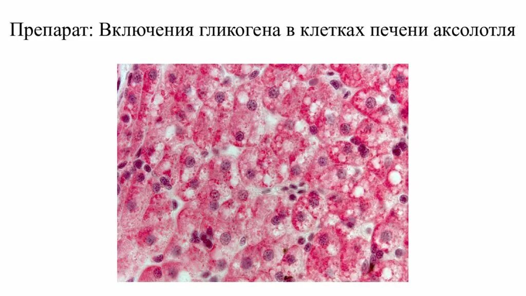 Митохондрии в клетках печени. Включения гликогена в печени аксолотля препарат. Препарат включения гликогена в клетках печени. Включение гликогена в печени аксолотля препарат гистология. Клетки печени гистология препарат.