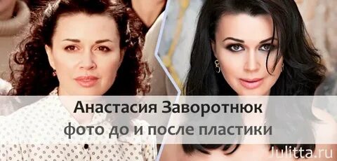 Заворотнюк до и после пластики