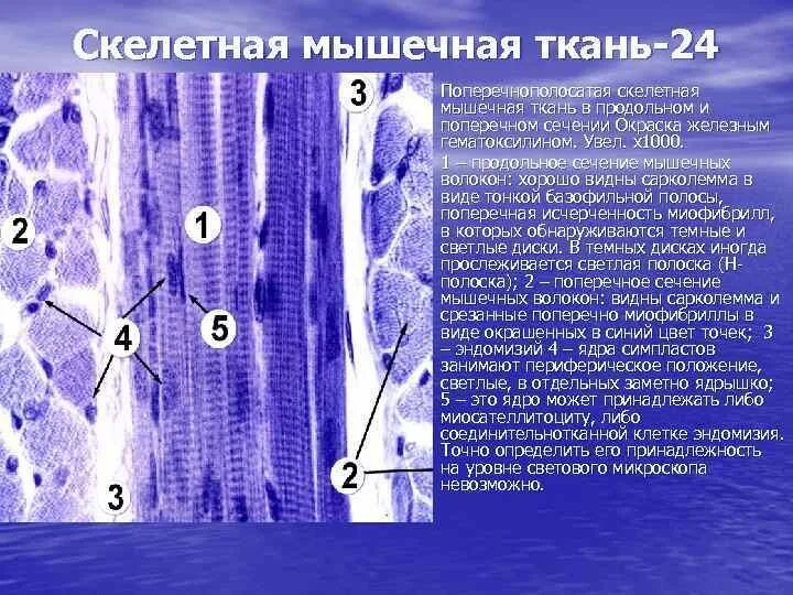 Поперечнополосатая Скелетная мышечная ткань гистология. Поперечнополосатая Скелетная мышечная ткань языка препарат. Скелетная мышечная ткань гистология. Скелетная мышечная ткань миосимпласт. Препарат поперечно полосатая мышечная ткань