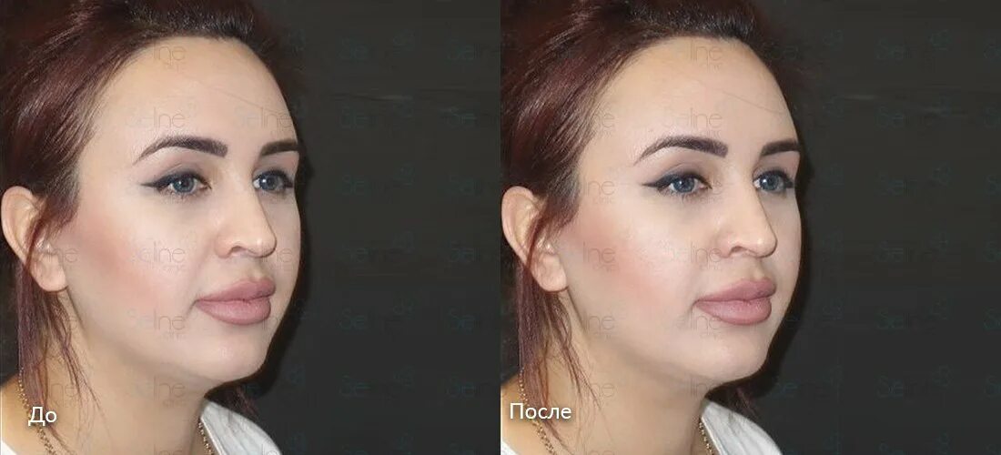 Селин евгений витальевич. Клиника селин на тимура фрунзе. Валовой кирилл геннадьевич пластический хирург тула. Seline пластические хирурги. Клиника селин москва.