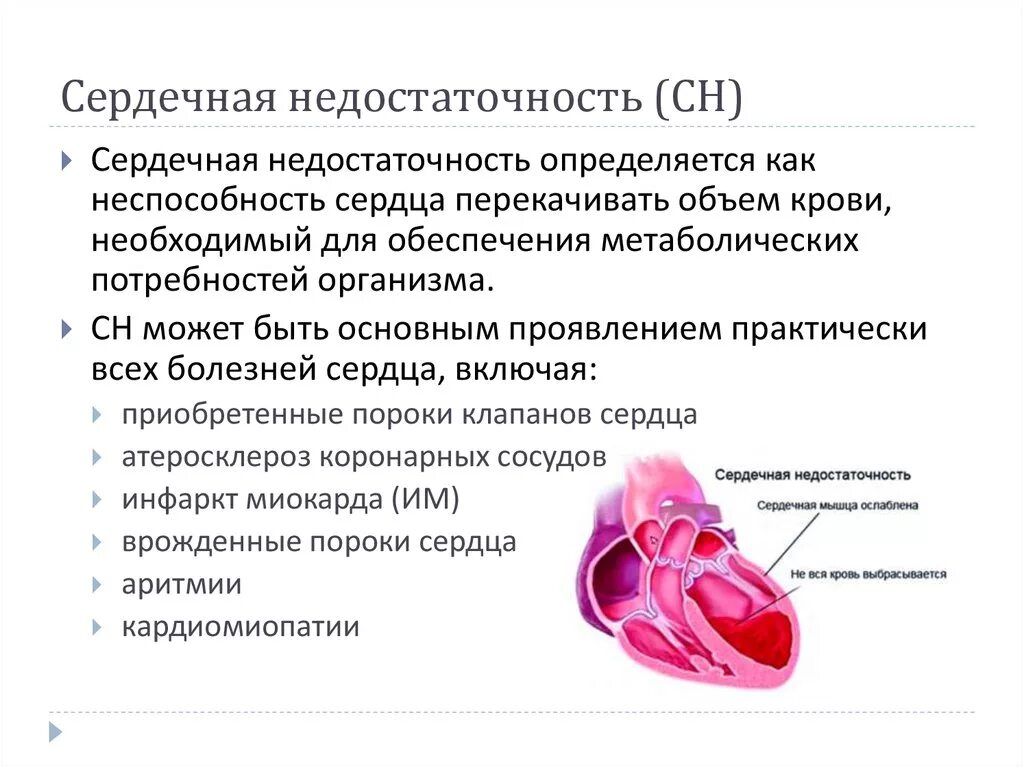 Симптомы острой сердечной недостаточности. Острая сердечная недостаточность патология. Недостаточность сердечно сосудистая 151.6. Причины развития острой сердечной недостаточности