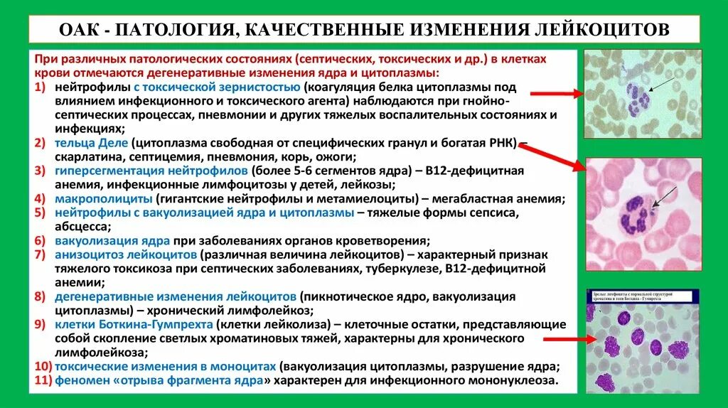 Изменения лейкоцитов в крови