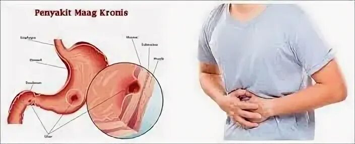 Мааг магазин одежды. Maag это бывший. Заменившие zara магазины maag. Maag это бывший. Maag вместо zara.