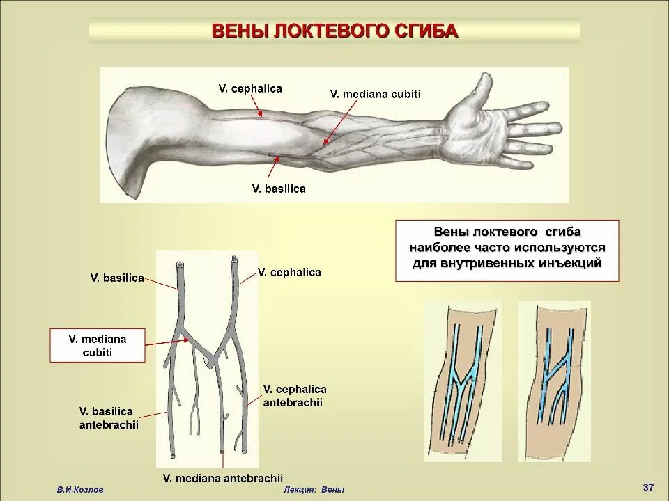 Срединная локтевая Вена. Кубитальная локтевая Вена. Периферическая Вена локтевого сгиба. Поверхностные вены локтевого сгиба.