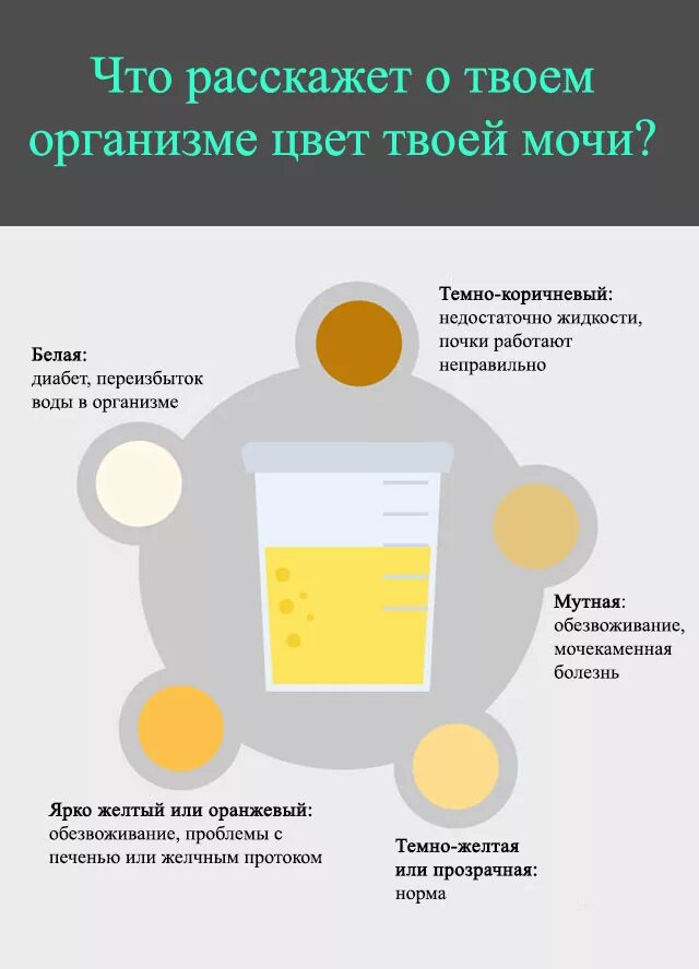Моча после месячных. Цвет мочи. изменение цвета мочи. мояа темножелтого цвета. моча тёмнгжёллого цвета.