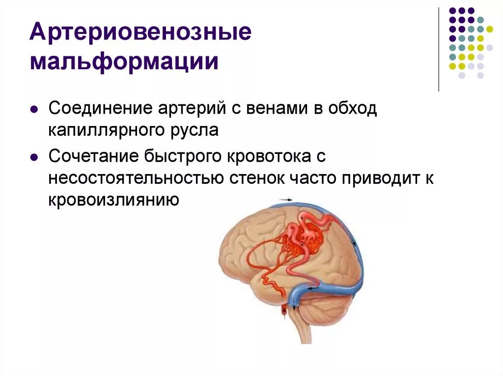 Мальформация. Артериовенозная мальформация патанатомия. пртерио венозная мальформация. артериовенозная мальформация нижних конечностей. врожденная венозная мальформация.