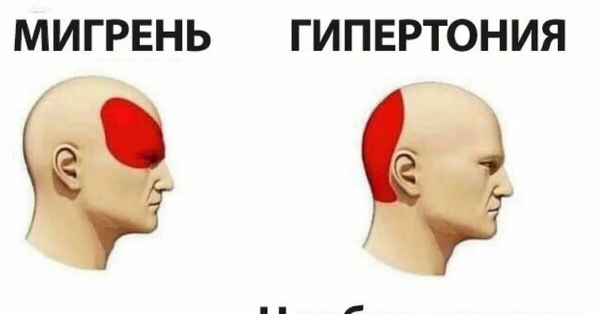 Типы головной боли. Не хочу у меня голова болит. У меня болит голова. Боль в голове. Не хочу у меня голова болит.