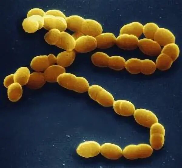 Болгарская палочка lactobacillus bulgaricus. Термофильные молочнокислые стрептококки. Болгарская палочка lactobacillus bulgaricus. Стрептококус термофилус. Bulgaricus.