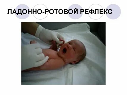 Ладонно ротовой рефлекс