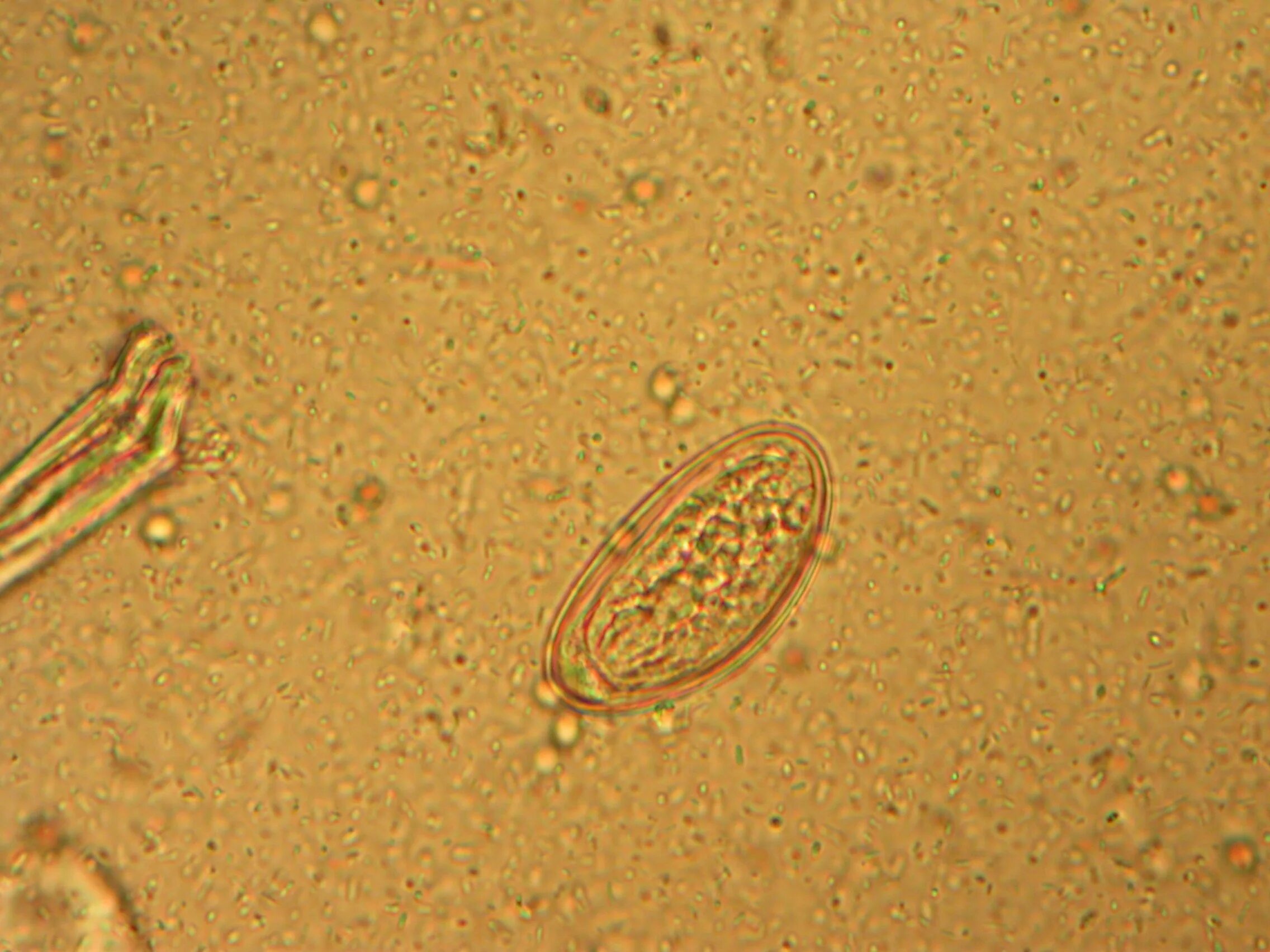 Enterobius vermicularis яйца. Enterobius vermicularis геогельминт. E vermicularis яйца. Купить яйца глист