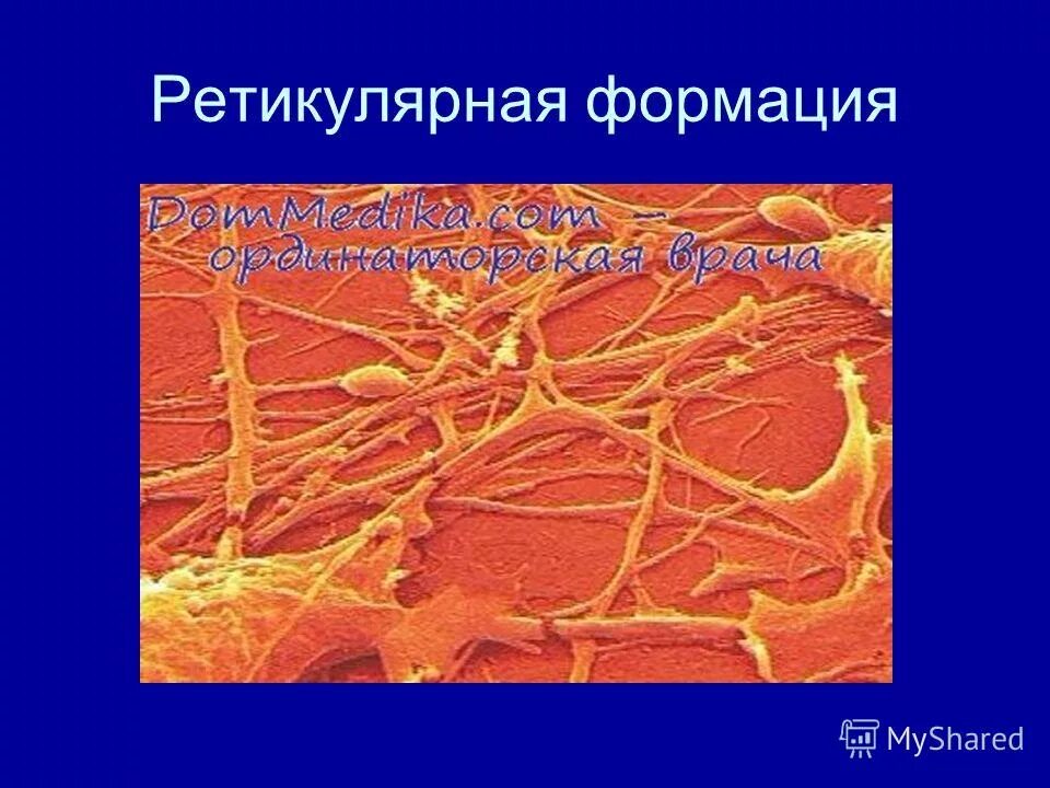 Ретикулярная (сетевидная) формация. Ретикулярная информация. Ретикуляция формации. Ретикулярная формация строение.