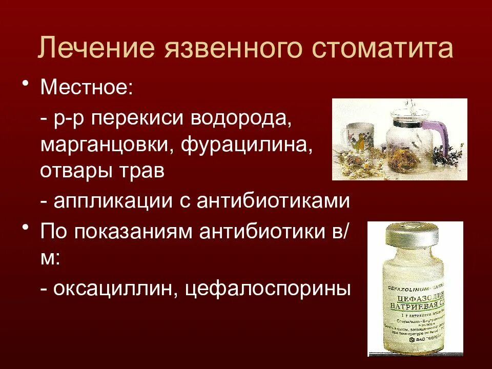Как быстро и эффективно вылечить стоматит. Антибиотики при стоматите. язвенный стоматит лечение. лекарство от язвенного стоматита.
