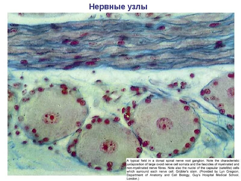 Нервный узел где. Нервные узлы. Нервные узлы ганглии. Вегетативное нервное сплетение гистология. Спинальный ганглий автономный вегетативный.