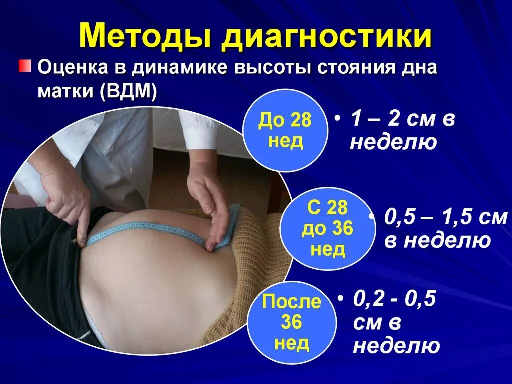 Ож и вдм. Измерение стояния дна матки беременной. Высота дна матки на 32 неделе беременности. Измерение окружности живота и высоты дна матки беременной. Высоты живота стояния дна матки.