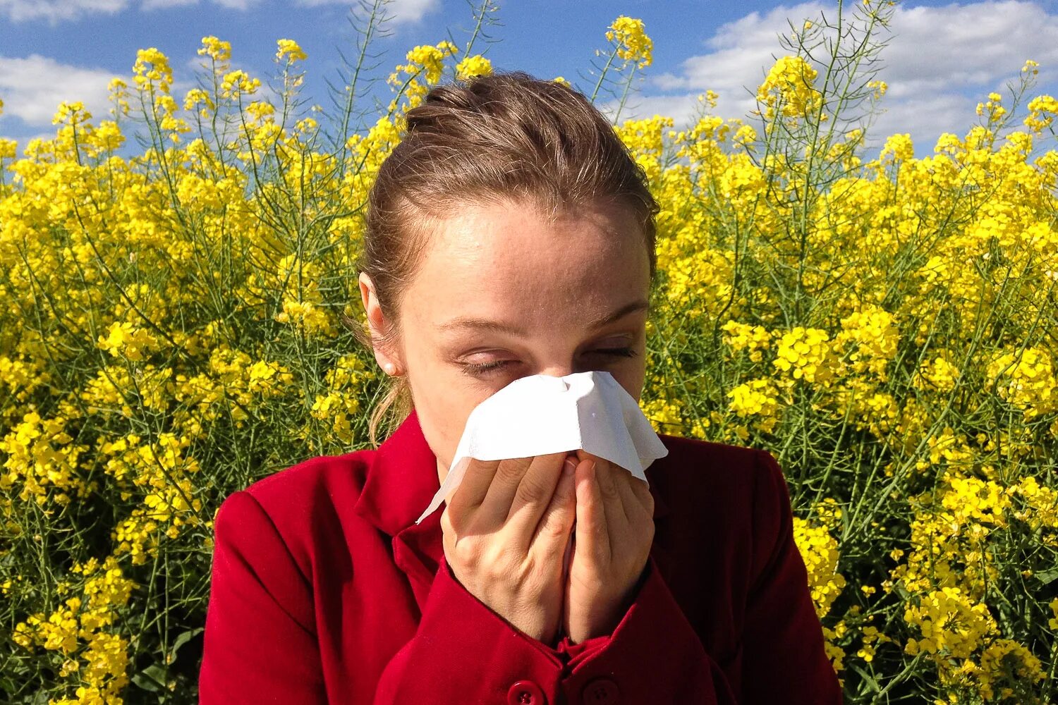 Летний насморк. Аллергия на пыльцу. Сезонная аллергия. Поллиноз.