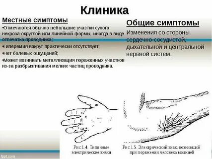 Общие проявления это