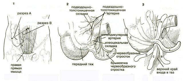 Перианальные кандидозы. Параректальный свищ (свищ прямой кишки). Перианальные складки где. Перианальные складки где. Пельвиоректальный свищ.