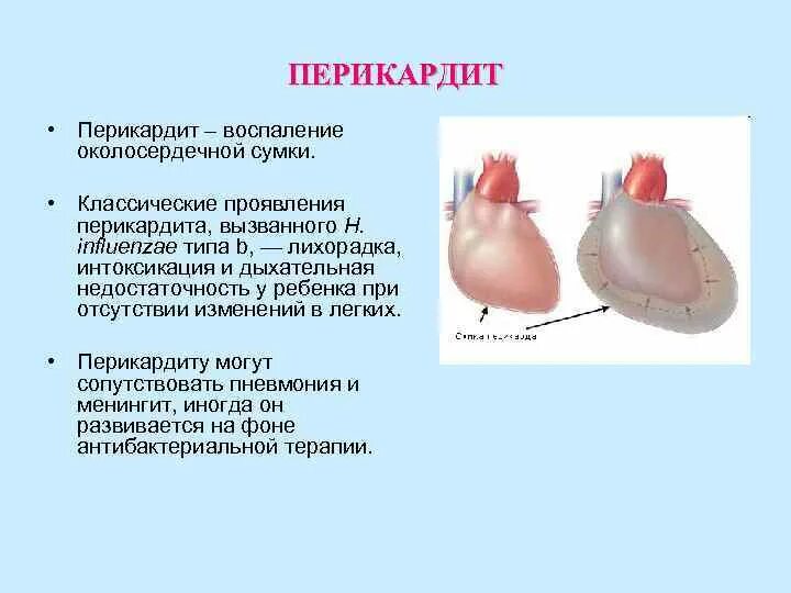 Сердце человека перикард. Околосердечная перикард. Перикард сердца анатомия. Околосердечная перикард. Околосердечная перикард.