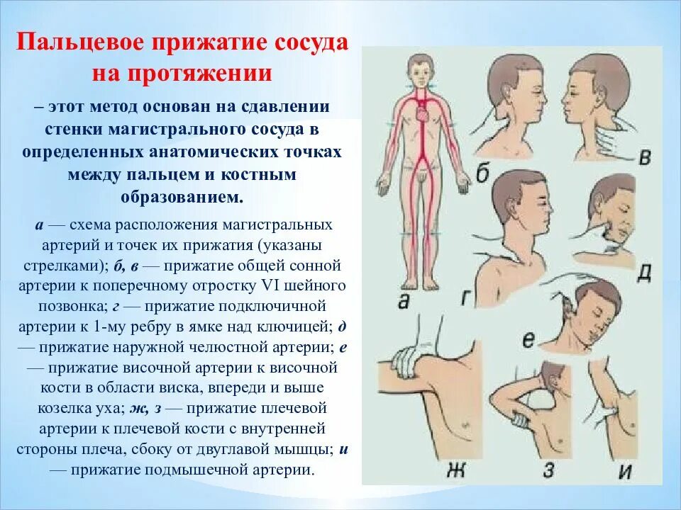 Способы остановки кровотечения лица. Способы остановки кровотечения. Типы кровотечения и способы их остановки. Виды кровотечений и способы их остановки кратко.