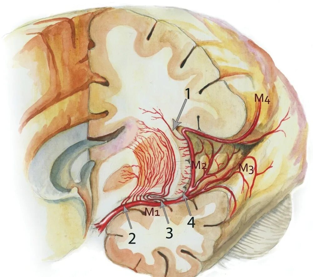 Сма мозга. Перфорантная артерия головного мозга. Перфорантные ветви средней мозговой артерии. Стриарные артерии. Лентикулостриарные артерии.