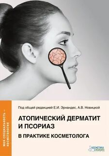 Атопический дерматит книги