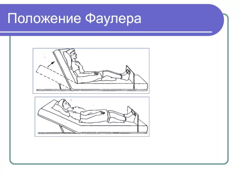 Положение Фаулера 45 градусов. Размещение пациента в позе Фаулера. Положение пациента Фаулера и симса. Положение Фаулера 30 градусов.