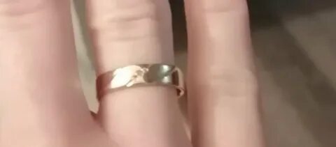 Кольца оставляют черные следы на пальцах