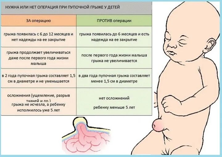 Уход за пупочным остатком - "Интернет-кабинет здорового ребенка"