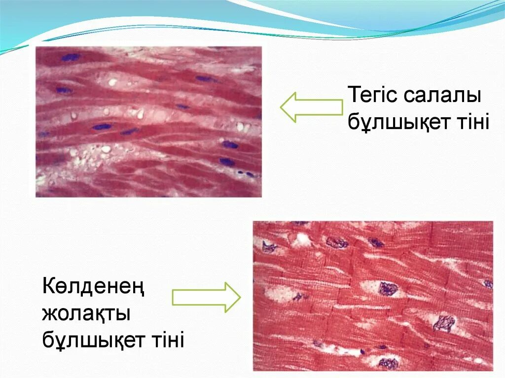 Виды мышечной ткани. Бұлшық ет ұлпаларының жіңішке филаменті. Бұлшық ет ұлпаларының жіңішке филаменті. Бұлшық ет ұлпаларының жіңішке филаменті. Бұлшық ет ұлпаларының жіңішке филаменті.