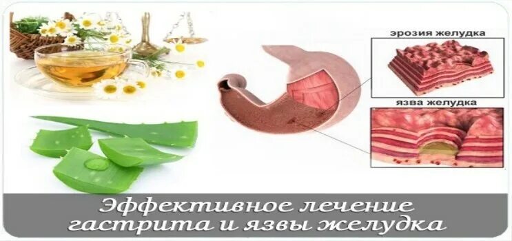 масло при эрозии желудка. масло при эрозии желудка. масло при эрозии желудка. травы для лечения эрозии желудка. масло при эрозии желудка.