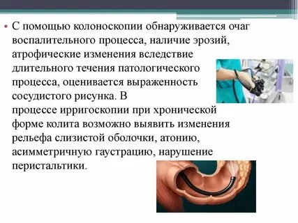 Колоноскопия вред