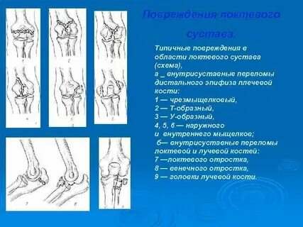 Повреждения суставов у детей