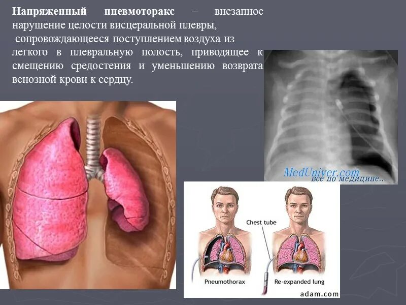 Последствия нарушений дыхания. Нарушенное дыхание. Нарушение дыхания у человека. Субъективные симптомы нарушения дыхания.