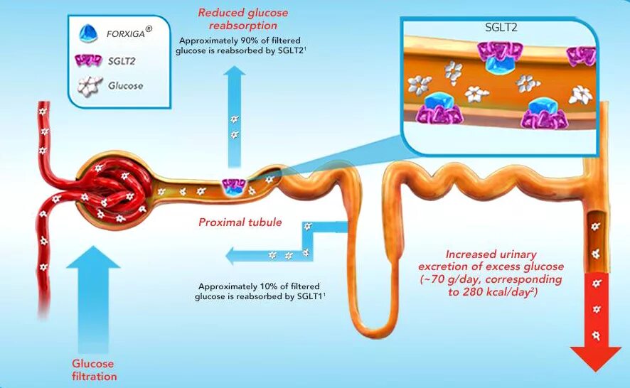 Ингибиторы натрий-глюкозного котранспортера-2 (sglt2i).. Форсига механизм действия. Дапаглифлозин механизм. Sglt2 механизм действия.