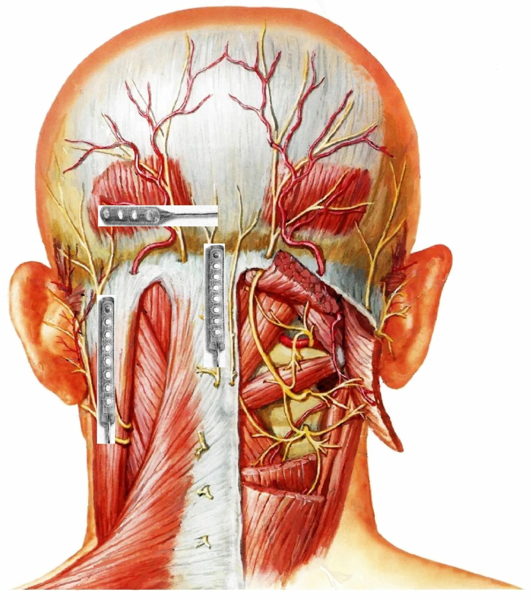 Затылок место. Невралгия затылочного нерва симптомы. Большой затылочный нерв анатомия. Подзатылочный нерв анатомия. Невралгия затылочного нерва нерва.