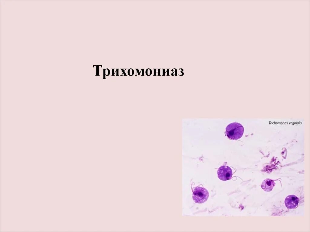 Презентация на тему трихомониаз. Трихомонада презентация. Хламидиоз трихомониаз презентация. Трихомоноз у мужчин симптомы